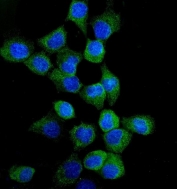 Immunofluorescent staining of FFPE human A431 cells with EGFR antibody (green) and DAPI nuclear stain (blue). HIER: steam section in pH6 citrate buffer for 20 min.
