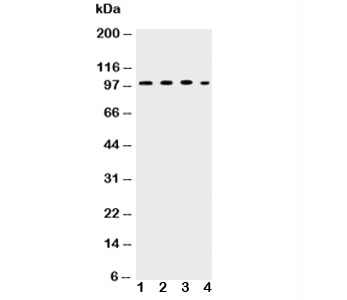 Western blot testing of ICAM-1 antibody and Lane 1: HEPG2; 2: K562; 3: A549; 4: HT1080 lysate. The glycoprotein is routinely visualized at 75~115KD.
