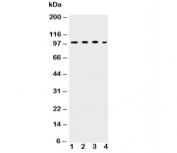 Western blot testing of ICAM-1 antibody and Lane 1:  HEPG2;  2: K562;  3: A549;  4: HT1080 lysate.  Predicted molecular weight: ~58/75-115 kDa (unmodified/glycosylated).
