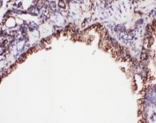 IHC-P: ICAM1 antibody testing of mouse lung tissue