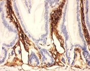 IHC-P: ICAM1 antibody testing of mouse intestine tissue