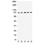 Western blot testing of ICAM1 antibody and rat samples 1: thymus;  2: spleen;  3: PC12;  4: NRK;  5: RH35 lysate. The expected molecular weight of this glycoprotein is 75~115 kDa.