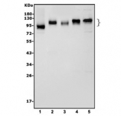 Western blot testing of 1) rat NRK, 2) mouse spleen, 3) mouse liver, 4) mouse kidney and 5) mouse ANA-1 cell lysate with ICAM1 antibody. Expected molecular weight: 75-115 kDa.