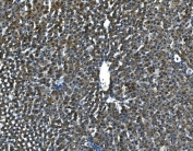 IHC-P: SAP antibody testing of rat liver tissue. HIER: steamed with pH6 citrate buffer.