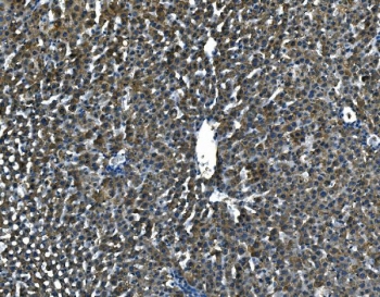 IHC-P: SAP antibody testing of mouse liver tissue. HIER: steamed with pH6 citrate buffer.
