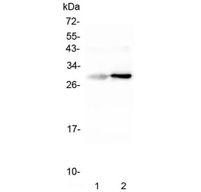 Western blot testing of 1) rat liver and 2) mouse liver tissue with Serum Amyloid P antibody. Predicted molecular weight ~25 kDa.~