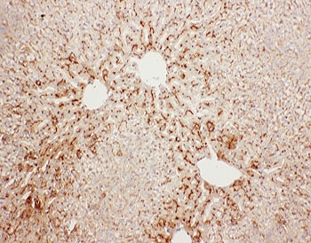 IHC-P: Serum Amyloid P antibody testing of rat liver tissue. HIER: steamed with pH6 citrate buffer.