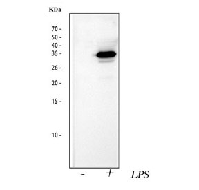 Western blot testing of IL1 beta antibody and rat testis lysate