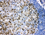 IHC-P: Ki67 antibody testing of FFPE human tonsil tissue. HIER: boil tissue sections in pH6, 10mM citrate buffer, for 20 min and allow to cool before testing.