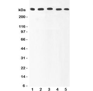 Western blot testing of Ki67 antibody and Lane 1: HeLa; 2: MCF-7; 3: COLO320; 4: HEPG2; 5: SKOV lysate. Predicted/observed size ~350KD