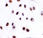 Immunocytochemical staining of FFPE human HeLa cells with Ki67 antibody. HIER: boil tissue sections in pH6, 10mM citrate buffer, for 20 min and allow to cool before testing.