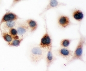 ICC testing of Bid antibody and human A549 cells.
