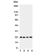 Western blot testing of Bid antibody and human samples 1:  HeLa;  2: COLO320;  3: Jurkat;  4: SKOV lysate.  Expected/observed molecular weight ~22 kDa.
