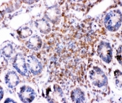 IHC-P: Bid antibody testing of rat intestine tissue