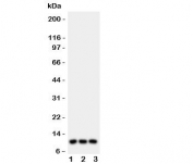 Western blot testing of CCL1 antibody and Lane 1:  U87;  2: MCF-7;  3: COLO320 lysate.  Expected/observed size ~10 kDa.