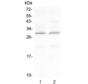 Western blot testing of 1) rat brain and 2) mouse brain with CNTF antibody. Predicted molecular weight ~23 kDa.