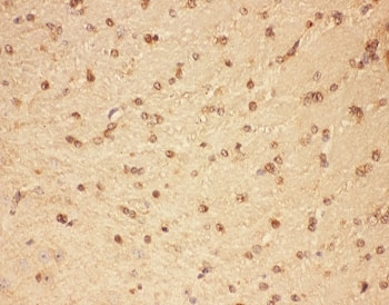 IHC-P: CNTF antibody testing of mouse brain tissue