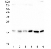 Western blot testing 1) rat heart, 2) rat spleen, 3) rat lung, 4) rat C6, 5) mouse spleen and 6) mouse HEPA1-6 lysate with Cofillin antibody. Predicted molecular weight ~19 kDa.