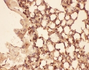 IHC-P testing of mouse lung tissue. HIER: steam section in pH6 citrate buffer for 20 min.