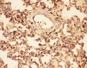 IHC-P testing of rat lung tissue. HIER: steam section in pH6 citrate buffer for 20 min.