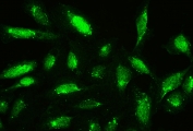 IF/ICC staining of FFPE human U-2 OS cells with Cofilin antibody (green) at 2ug/ml. HIER: steam section in pH6 citrate buffer for 20 min.