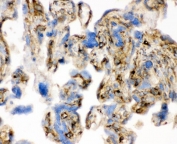 IHC staining of frozen human placenta with Cofillin antibody.