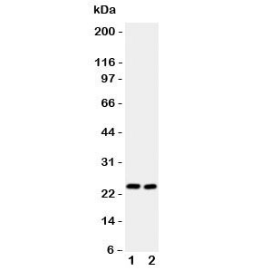 Western blot testing of IL6 antibody and Lane 1: (m) HEPA; 2: (m) NIH3T3 lysate. Expected size ~24KD