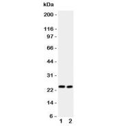 Western blot testing of IL6 antibody and Lane 1: mouse HEPA1-6;  2: (m) NIH3T3 lysate.  Expected molecular weight ~24 kDa.