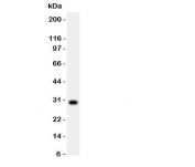 Western blot testing of MMP7 antibody and A549 lysate. Predicted molecular weight ~30kDa.