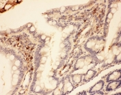 IHC-P: MMP7 antibody testing of rat intestine tissue
