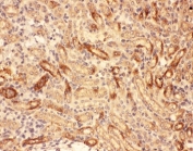 IHC-P: MMP7 antibody testing of mouse kidney tissue