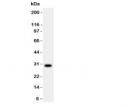 Western blot testing of MMP7 antibody and rat brain lysate. Predicted molecular weight ~30kDa.