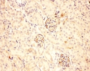 IHC-P: ACTH antibody testing of mouse kidney tissue