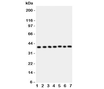 Western blot testing of ARA9 antibody and Lane 1: HeLa; 2: COLO320; 3: HT1080; 4: MCF-7; 5: SW620; 6: U87; 7: MM231; Predicted/Observed size: 37KD