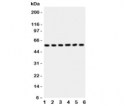 Western blot testing of AKT2 antibody and Lane 1:  HeLa;  2: PANC;  3: A549;  4: COLO320;  5: HT1080;  6: MCF-7 lysate. Predicted molecular weight: ~56kDa.