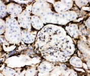 IHC-P: Annexin V antibody testing of mouse kidney tissue. HIER: boil tissue sections in pH6, 10mM citrate buffer, for 10-20 min and allow to cool before testing.