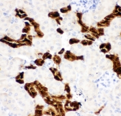 IHC-P: Calbindin antibody testing of mouse kidney tissue. HIER: steam section in pH6 citrate buffer for 20 min and allow to cool prior to staining.