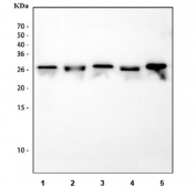 IHC-P: Calbindin antibody testing of mouse kidney tissue. HIER: steam section in pH6 citrate buffer for 20 min and allow to cool prior to staining.