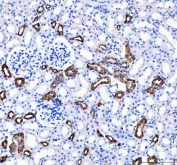 IHC staining of FFPE rat kidney tissue with Calbindin antibody. HIER: boil tissue sections in pH8 EDTA for 20 min and allow to cool before testing.