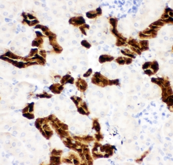 IHC-P: Calbindin antibody testing of mouse kidney tissue