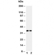 Western blot testing of Calbindin antibody (0.5ug/ml) and rat lysate samples 1) brain, 2) kidney.  Expected molecular weight: 27-28 kDa, observed here at ~37 kDa.