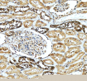 IHC staining of FFPE human kidney tissue with Calbindin antibody. HIER: boil tissue sections in pH8 EDTA for 20 min and allow to cool before testing.