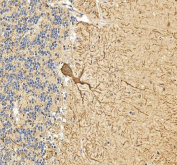 Flow cytometry testing of human HeLa cells with Calbindin antibody at 1ug/10^6 cells (blocked with goat sera); Red=cells alone, Green=isotype control, Blue= Calbindin antibody.