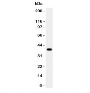 Western blot testing of Cathepsin B antibody and human HepG2 lysate.  Molecular weight: 38-46 kDa depending on glycosylation level. An ~31 kDa form (propeptide removed) may be observed and may be further processed into an ~25 kDa heavy chain and ~5 kDa light chain.