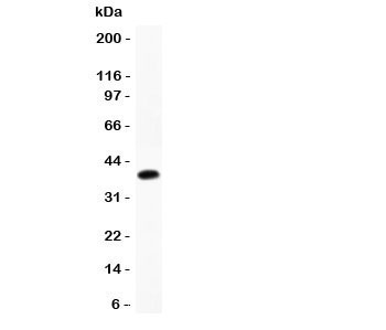 Western blot testing of Cathepsin D antibody and recombinant human protein (0.5ng)~