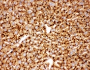IHC-P: Cathepsin D antibody testing of mouse liver tissue