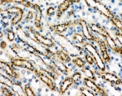 IHC-P: Cathepsin D antibody testing of mouse kidney tissue