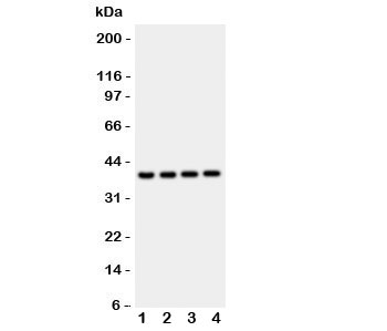 Western blot testing of Cathepsin D antibody and mouse samples: 1: liver; 2: brain; 3: thymus; 4: Neuro-2a lysate. Predicted molecular weight: 43-46 kDa and 28/15 kDa heavy/light chain.