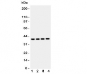 Western blot testing of Cathepsin D antibody and mouse samples:  1: liver;  2: brain;  3: thymus;  4: Neuro-2a lysate. Expected molecular weight: 43-46 kDa, 28 kDa (heavy chain), 15 kDa (light chain).