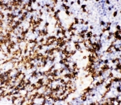 IHC staining of FFPE human tonsil with CD20 antibody. HIER: boil tissue sections in pH6, 10mM citrate buffer, for 10-20 min and allow to cool before testing.